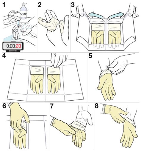 Step By Step Sterile Technique For Putting On Gloves Saint Lukes