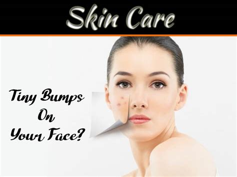 How To Get Rid Of Tiny Bumps On Your Face 99 Health Ideas