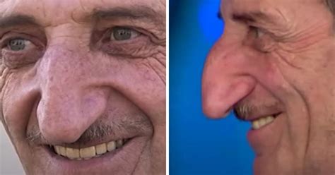 Man 71 Holds Record For Worlds Longest Nose — And Its Only Getting