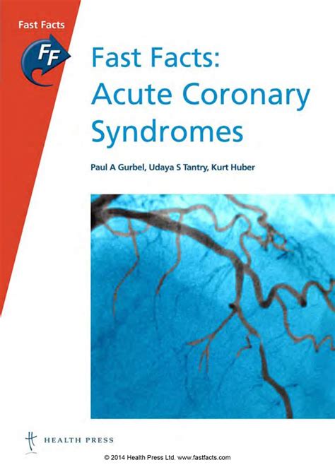 Fast Facts Acute Coronary Syndromes 9781908541475 Books Amazonca