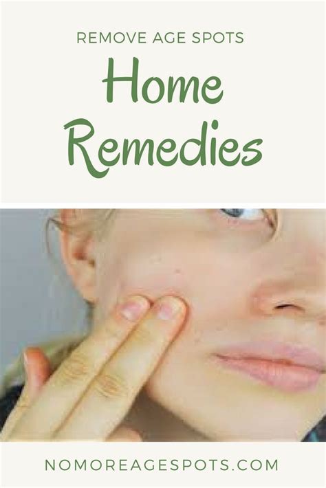 Remove Age Spots With These Home Remedies What Really Works And What Doesnt Agespots