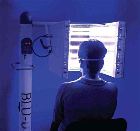 Blu U Therapy As Acne Treatment Laser Aesthetics 905 332 9930