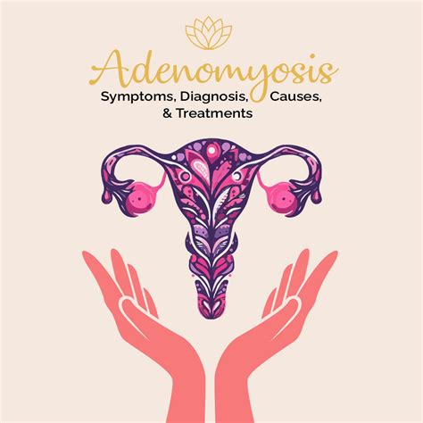 Adenomyosis Symptoms Diagnosis Causes And Treatments Fibroid
