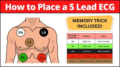 How To Place A 5 Lead Ecg Mnemonic Electrode Placement Made Easy