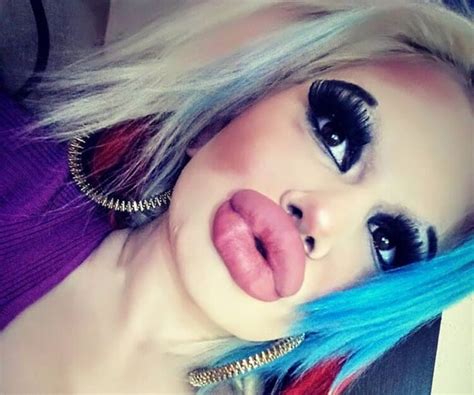 Cette femme qui a triplé la taille de ses lèvres pour être plus à la mode montre à quoi elle