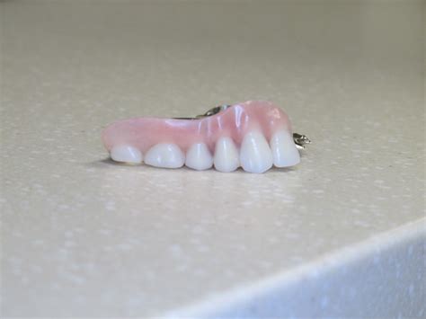 Precision Attachment Partial Dentures Dr Andrew Willoughby