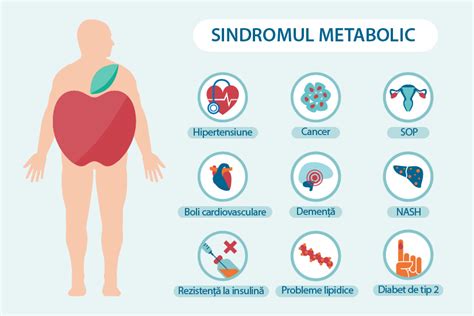 Sindromul Metabolic Reginamaria Ro