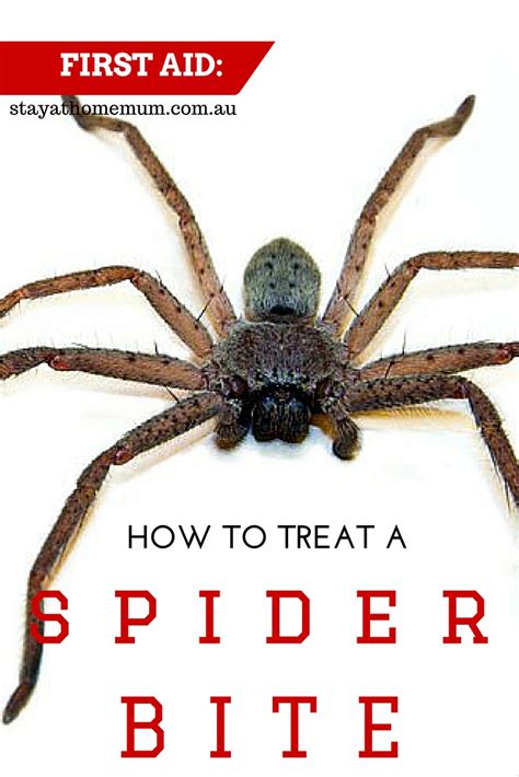 First Aid How To Treat A Spider Bite Stay At Home Mum