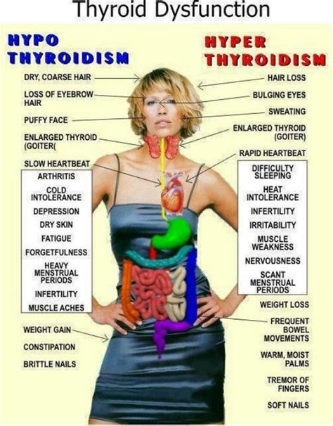 Up to 5% of the population has this diagnosis (and it probably goes undiagnosed in even more people). Hyperthyroidism (Overactive thyroid), Graves disease ...