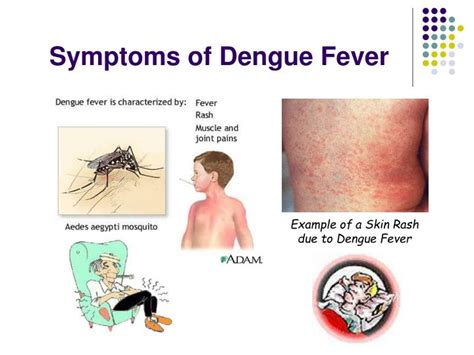 An outbreak of rashes following the onset of dengue fever brings with it a number of complications. PPT - Dengue Prevention PowerPoint Presentation - ID:1827011