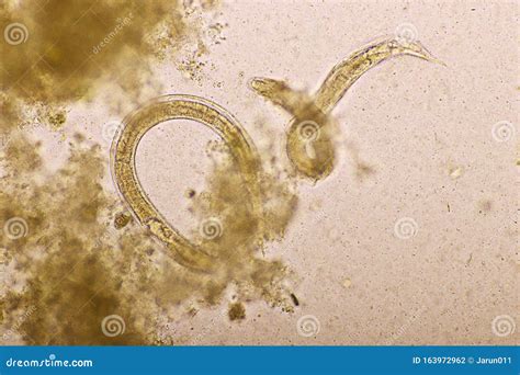 Strongyloides Stercoralis Or Threadworm In Human Stool Stock Photo