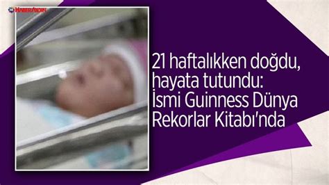 21 haftalıkken doğdu hayata tutundu İsmi Guinness Dünya Rekorlar