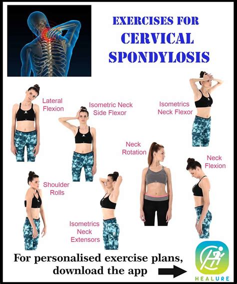 Neck Strengthening Exercises For Cervical Spondylosis Exercise Poster Hot Sex Picture