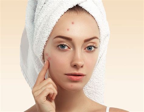 5 Natural Acne Spot Treatments Acne Spot Treatment Acne Treatments