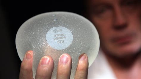 A Quarter Of Removed Pip Breast Implants Had Signs Of Splitting Or