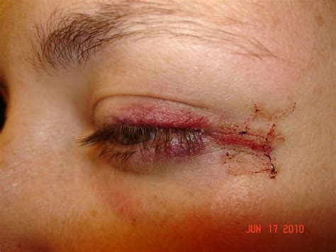 Pin Bad Permanent Makeup 33 Make Up Failssomeone Please Help Them