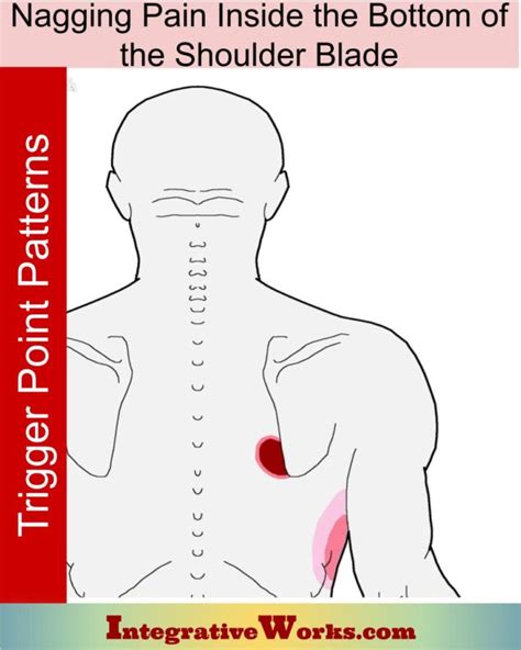 Pain Between Shoulder Blades Pain Patterns Causes Self Care