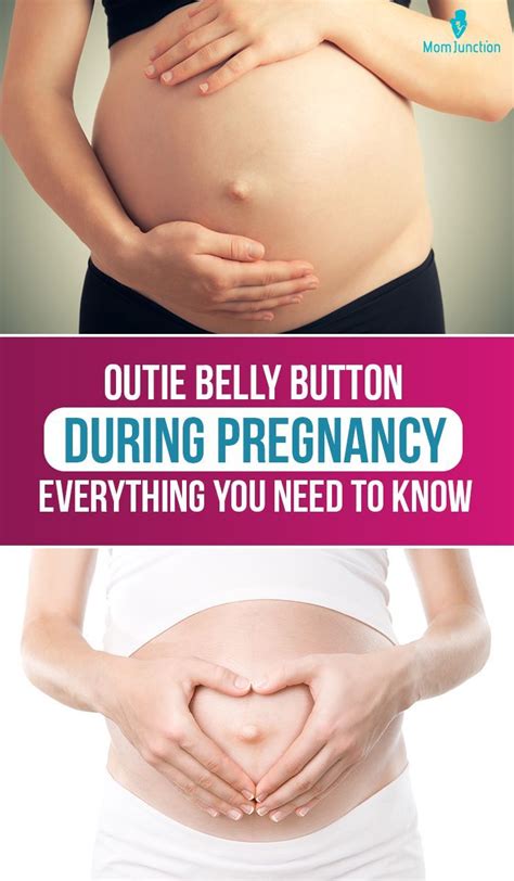Why Your Belly Button Pops Out During Pregnancy Artofit