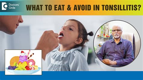 Repetitive Tonsillitis Food To Eat And Avoid In Severe Throat Pain Dr