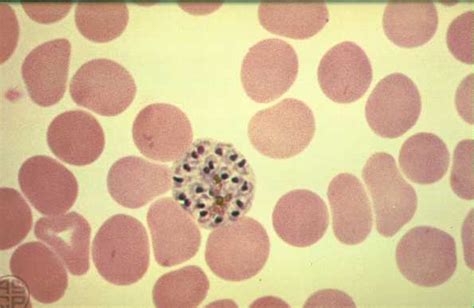 This Thin Film Giemsa Stained Micrograph Depicts A Plasmodium Vivax