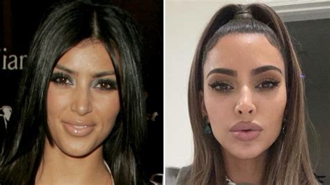 kim kardashian before and after plastic surgery timeline