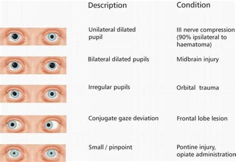 Assessment Eyes Flashcards Quizlet