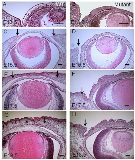 He Histology Of Eyes Of A Wt Embryo And A Mutant Embryo With