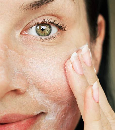 10 Natural Remedies To Get Rid Of Acne On Dry Skin