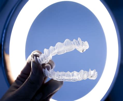 Invisalign Facts — 9 Things You Should Know — Solid Wheel