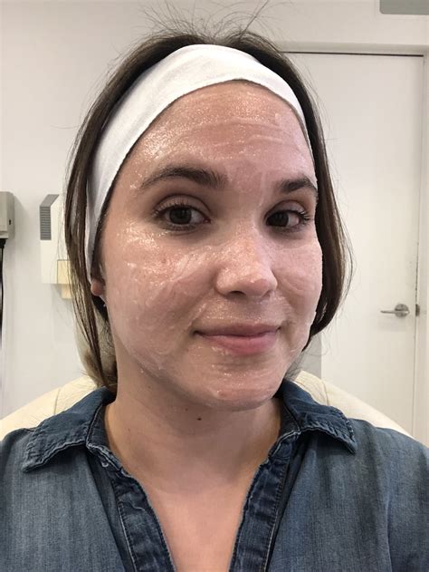 Clear Brilliant Laser Skin Care Treatment Honest Reviewhellogiggles