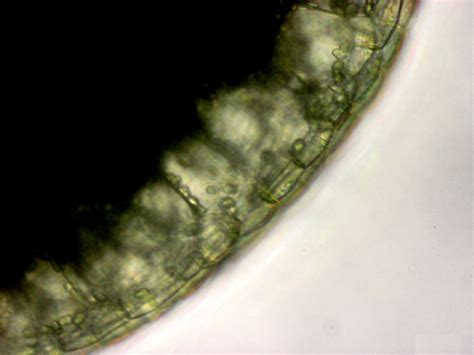 Phycokey Aquatic Macrophytes Wolffia Starch Grains Images