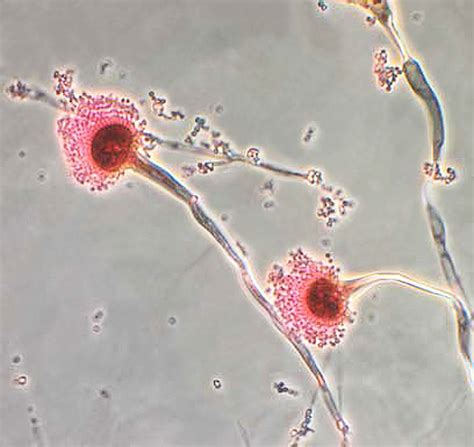 Pnnl Chemical Probe Finds Fungal Organism Function