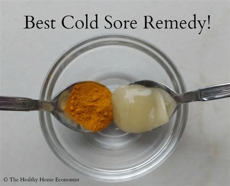 Effective Home Remedies For Cold Sores Healthy Home Economist