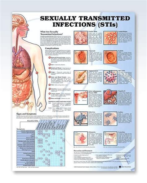 Sexually Transmitted Infections 20x26 Sexually Transmitted Sexually