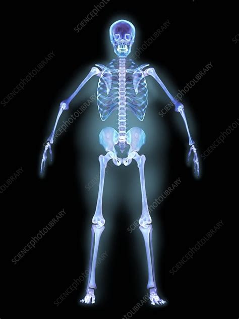 Obese Man X Ray Artwork Stock Image P1000223 Science Photo Library