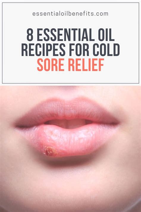 8 Essential Oil Recipes For Cold Sore Relief Essential Oil Benefits