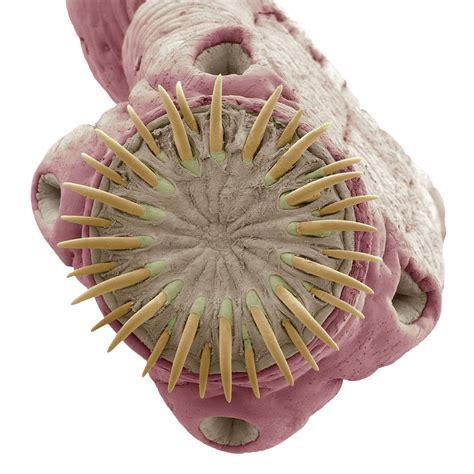Images Of Distinction Pork Tapeworm Laboratory News