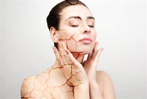 What To Do About Dry Cracked Skin In The Winter Integrated