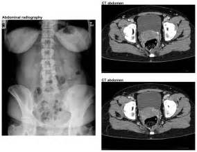 Urinary Tract Stones Notes A 36 Year Old Female Presented At The