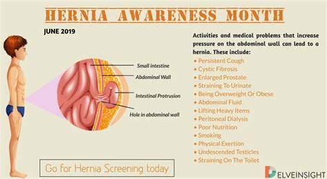 Hernia Awareness Month Delveinsight Business Research