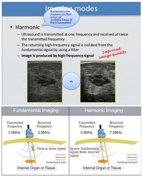 Harmonic Imaging Is A Technique In Ultrasonography That Provides Images