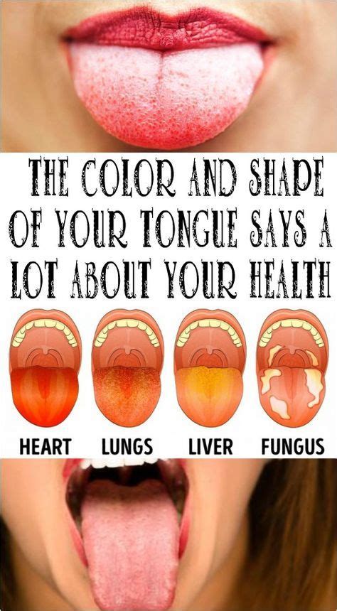 The Color And Shape Of Your Tongue Says A Lot About Your Health Tongue Health Health Coconut