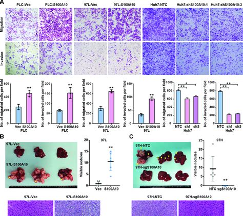 S A Promotes Hcc Migratory Invasive And Metastatic Abilities In