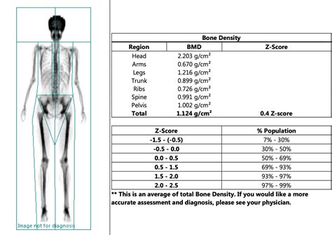 My Experience With A Dexa Scan What Is It And Is It Worth It — Whole