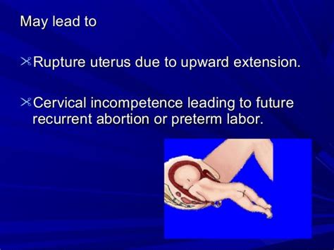 Maternal Obstetric Injuries For Undergraduate