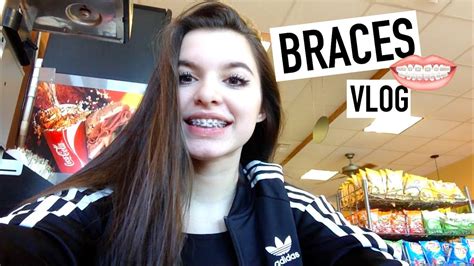 Getting Braces On Vlog Youtube