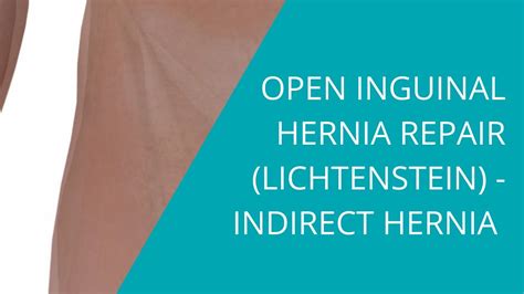 Open Inguinal Hernia Repair Lichtenstein Indirect Hernia Youtube