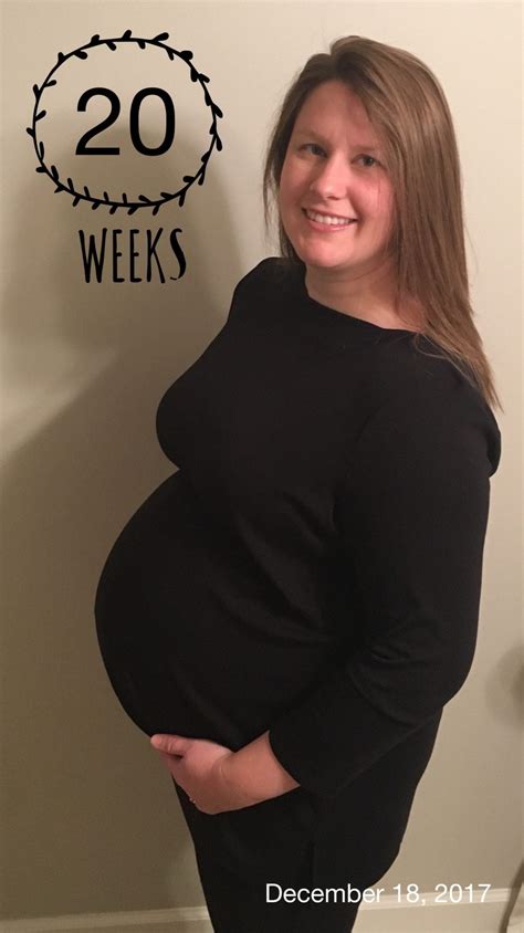 20 Weeks Pregnant With Twins Twiniversity