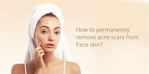 How To Permanently Remove Acne Scars From Face Skin