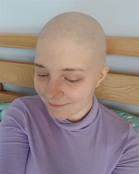 My Hair Growth After Chemo Griffblog UK Fashion Lifestyle